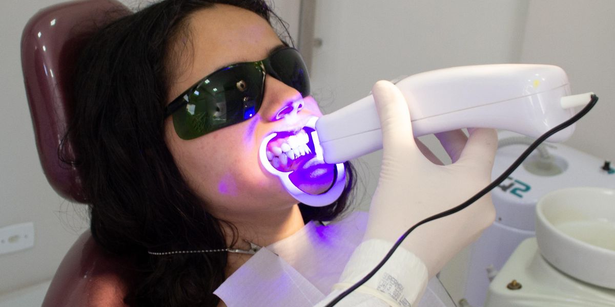 Sbiancamento dentale